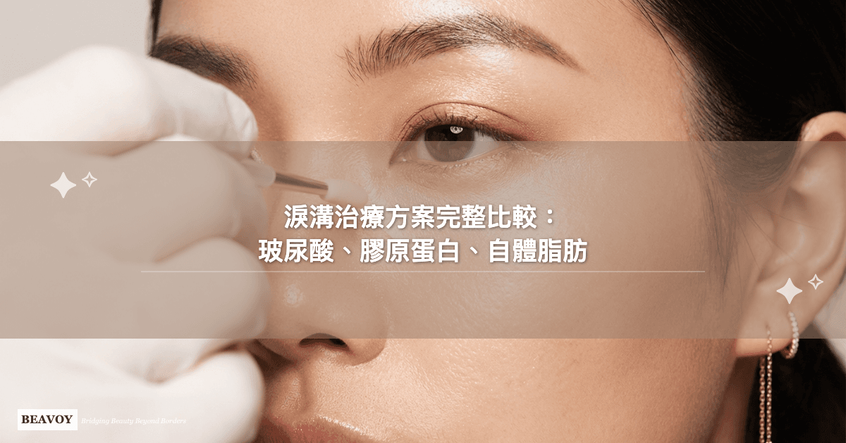 淚溝治療方案完整比較：玻尿酸、膠原蛋白、自體脂肪一次搞懂